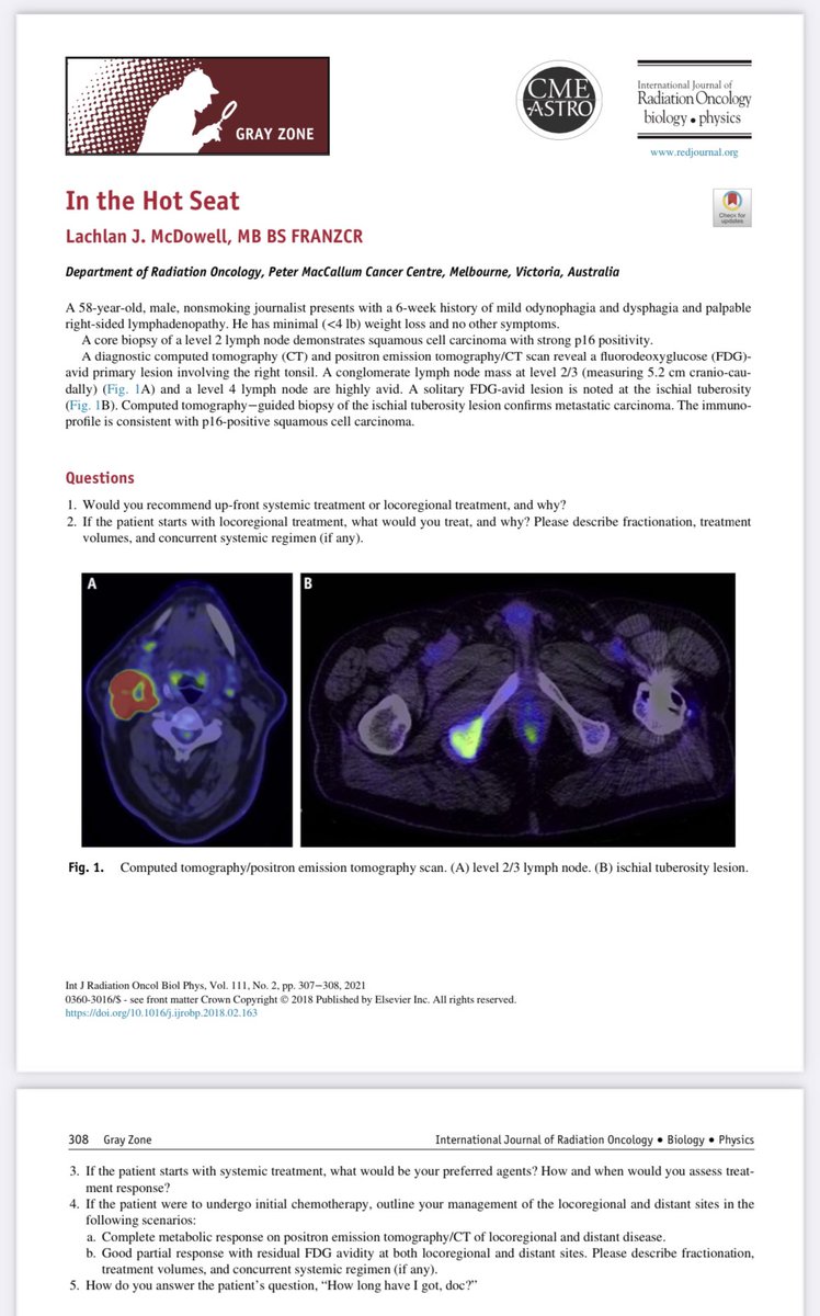 New #gyzone case from @lachiemcd: De-novo oligometastatic p16+ H&N cancer bit.ly/3jvFuaq #radonc #hncsm #openaccess