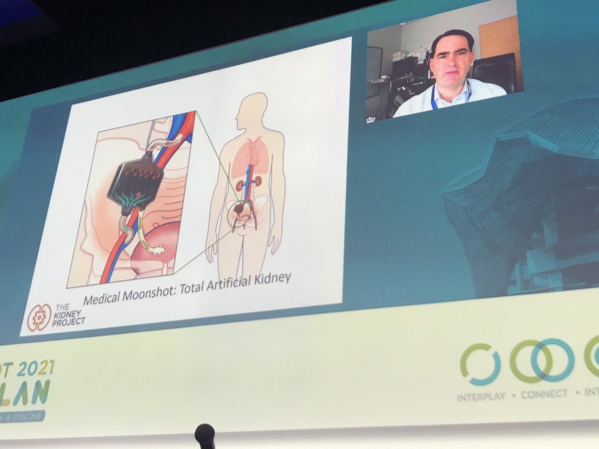 The future of #kidney #transplantation? The implantable total #artificial #kidney ? #ESOTcongress <a href="/WilliamFissel/">Fissel</a> @VUMCTransplant
