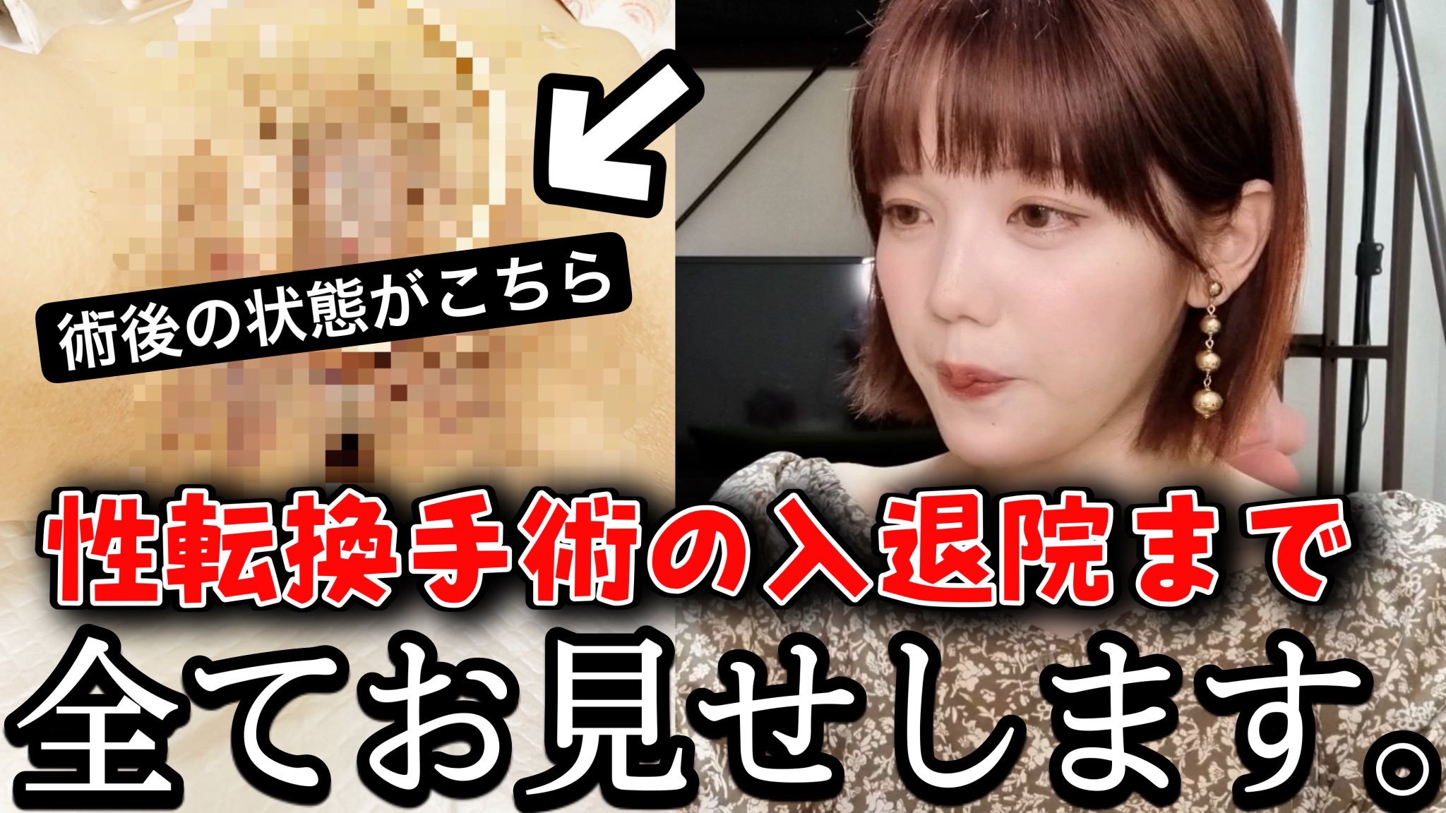性転換  / X