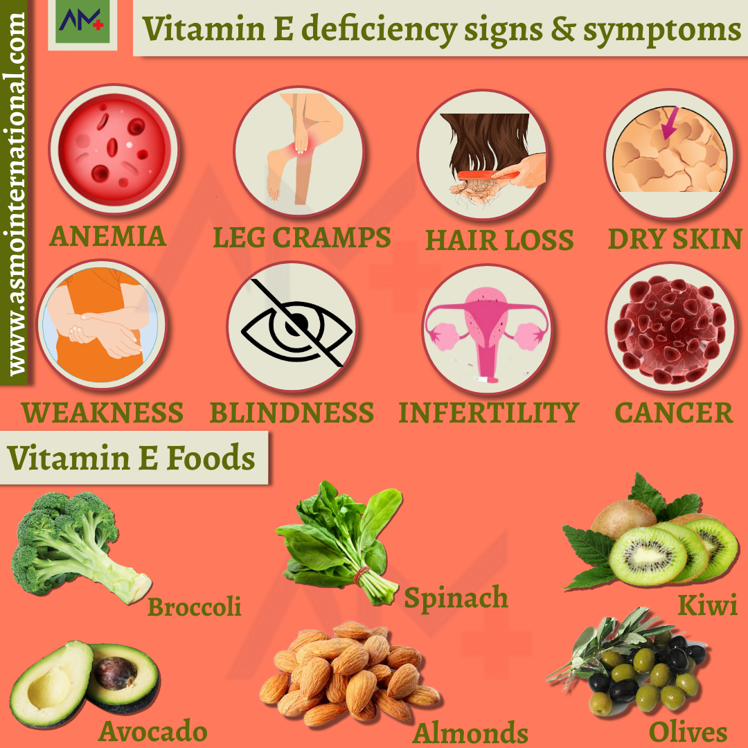 Vitamin deficiency. Deficiency Symptoms Vitamin e. Vitamin ABCD deficiency.