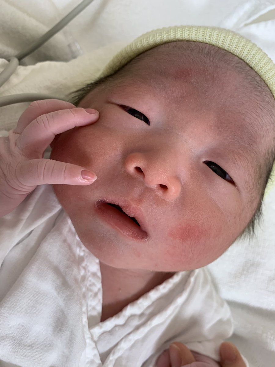 reina_trym's tweet photo. #心が乱れそうな時はみんな新生児の頃の写真見て初心に帰ろうぜ
あの頃は泣くと目が一文字になってたのが懐かしい👶🏻 https://t.co/0mOHlD5RLQ