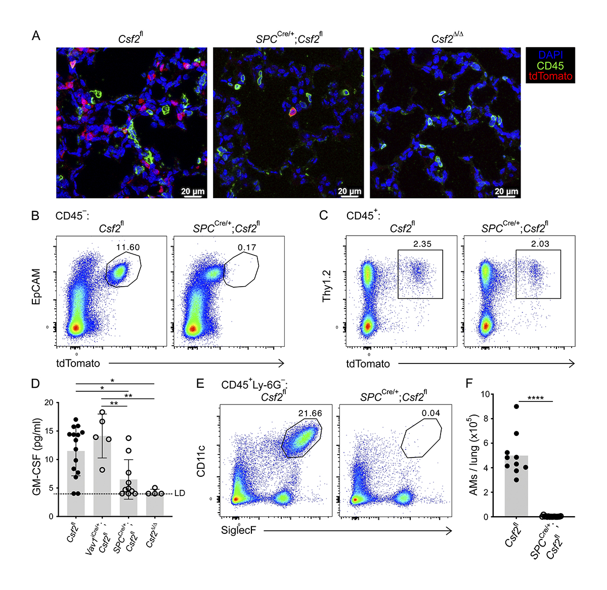 JExpMed's tweet photo. Alveolar macrophages rely on GM-CSF from alveolar epithelial type 2 cells before and after birth, say @gschwend_julia, @ChSchneider_PhD @UZH_en and colleagues. https://t.co/grEwOEPwhF
#InnateImmunity #inflammation #MucosalImmunology https://t.co/EQZ9M7mOPv
