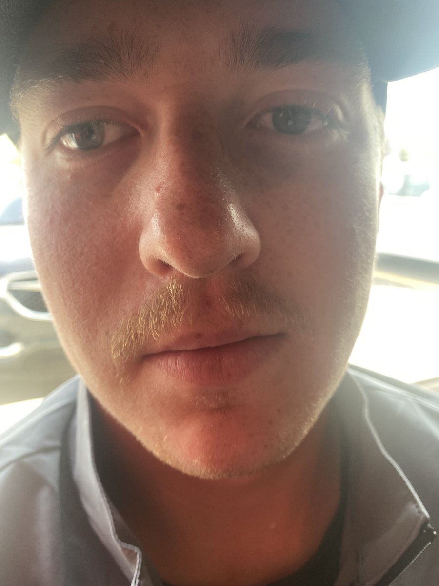 Middle of <a href="/MacFisshhh/">mac</a> moustache got lost at baggage. Very unfortunate. <a href="/WestJet/">WestJet</a> is there anything we can do about this?