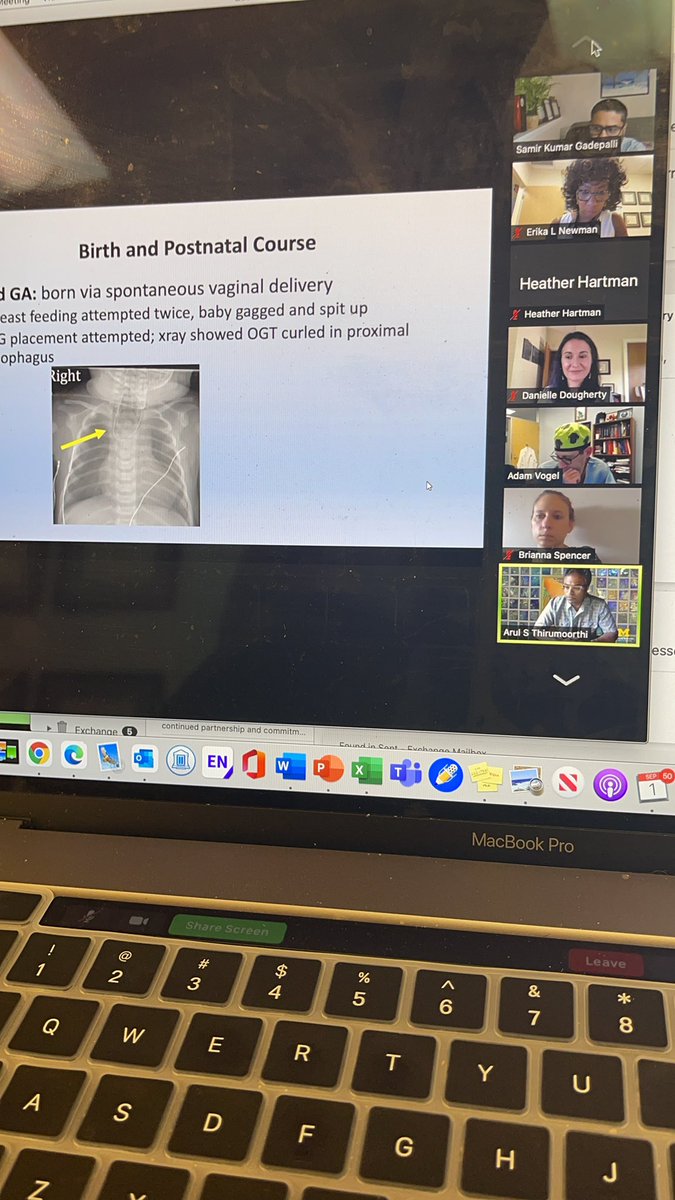 Erika Adams Newman (@erikaanewman) on Twitter photo HAPPENING now- <a href="/APSASurgeons/">APSA Surgeons</a> <a href="/apstpd/">APSTPD</a> Critical Care Conference on management of newborn TEF - expert team led by <a href="/SamirGadepalli/">Samir Gadepalli</a> <a href="/DanielleJoanMD/">Danielle Dougherty</a> HAPPENING now- <a href="/APSASurgeons/">APSA Surgeons</a> <a href="/apstpd/">APSTPD</a> Critical Care Conference on management of newborn TEF - expert team led by <a href="/SamirGadepalli/">Samir Gadepalli</a> <a href="/DanielleJoanMD/">Danielle Dougherty</a>