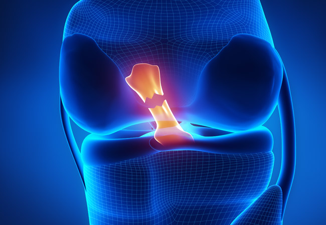 SPRINT_ACU's tweet image. In collaboration with @JohnAHawley and @NolanHoffmanLab from @MacKillopACU, @SPRINT_ACU has received funding from @DSI_VIC to explore the molecular mechanisms for quadriceps atrophy following ACL injury.