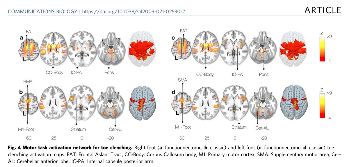 1/ Exciting new #colaboration btw <a href="/VNozais/">Victor Nozais</a> , <a href="/StephForkel/">Stephanie Forkel</a> , <a href="/FoulonChris/">Chris Foulon</a> , @thiquemat  &amp; <a href="/MichelTdS/">Michel Thiebaut de S</a> is now out in <a href="/CommsBio/">Communications Biology</a> : 
Functionnectome as a framework to analyse the contribution of brain circuits to fMRI. 
Read the paper here: nature.com/articles/s4200…

A thread
