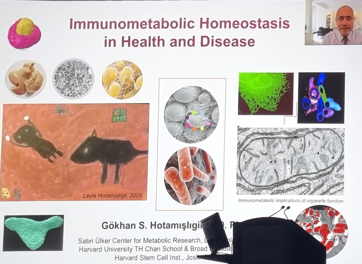 Gökhan Hotamışlıgil showing the breadth and depth of evidence linking inflammation and chronic disease.
The take home is that hard science supports what we do day to day in Lifestyle Medicine #BSLM2021 <a href="/BritSocLM/">British Society of Lifestyle Medicine</a>