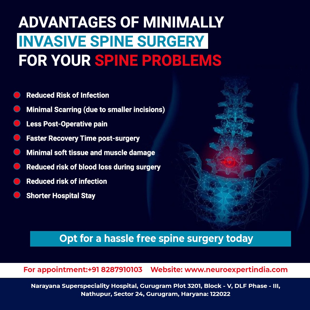 neuro_expert's tweet photo. Considering spine surgery? 
Here’s a suggestion- Minimally Invasive Spine Surgery. MIS offers several advantages over the very traditional open spine surgery.

💻Visit our website to know more: https://t.co/yxt459xEk8
 
#spinesurgery 
#spinesurgeryrecovery
#delhincr https://t.co/maWSzpgoe5