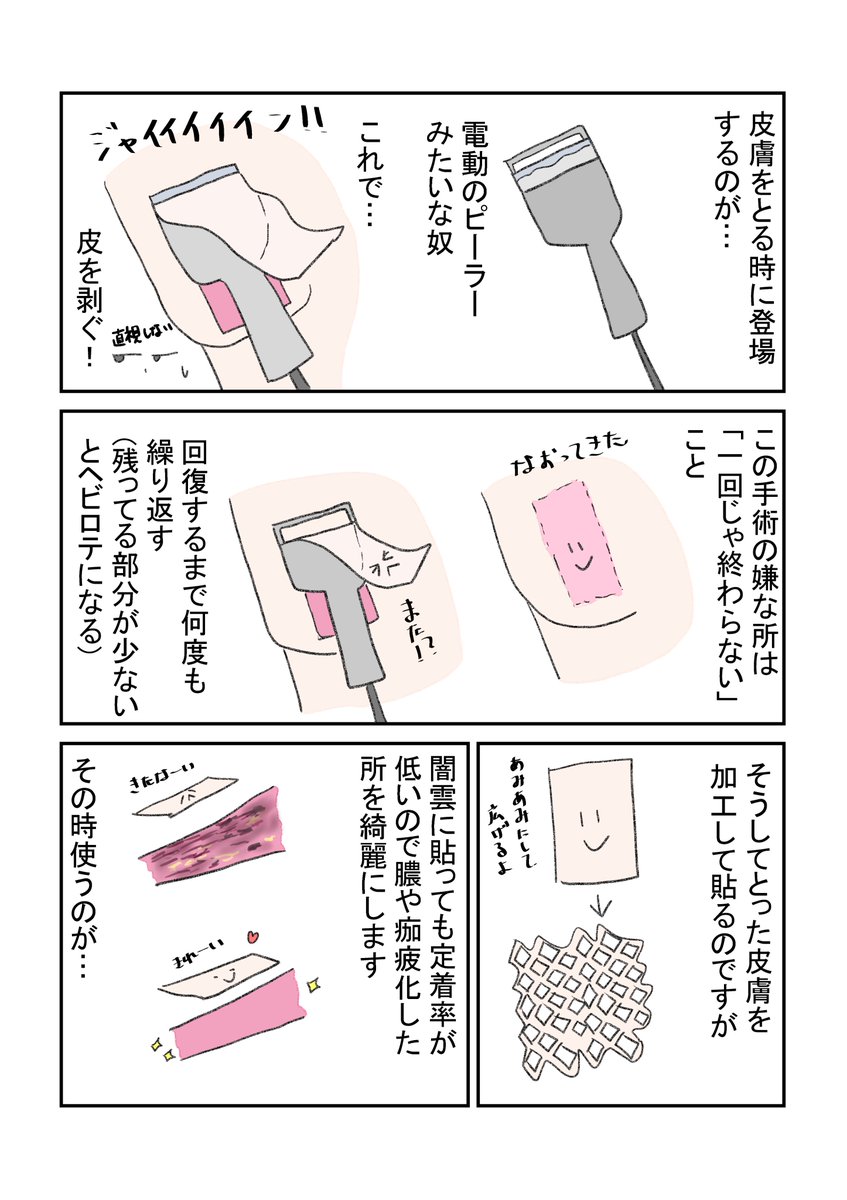 私的痛い手術ベストだよ😇
大した事なかったらゴメン
やはり皮剥ぎ系が苦手👻
ただこれ手術操作の痛さランクで、手術に来た時点で痛いベストは巻き込まれ系がダントツだと思います(コンバインとかゴミ収集車とか)