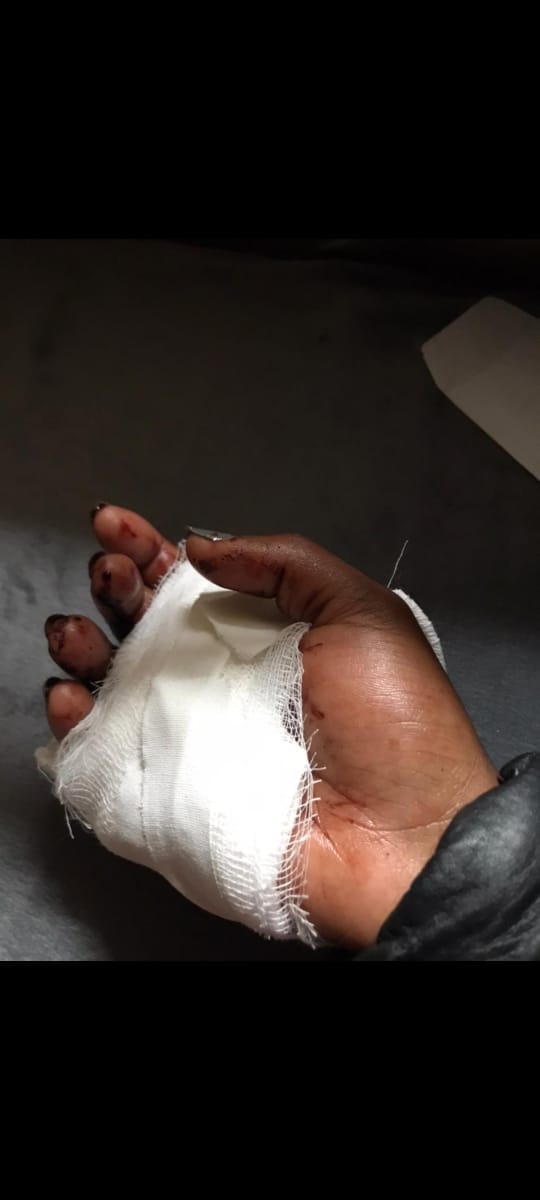 miss_ajaay's tweet photo. It has been 3 days since Waithera Susan was assaulted by a bolt driver, Samuel of KCR 244Y, 0753299533. It's really sad that no justice has been taken and the driver is still walking freely. We need justice! @ntsa_kenya @Boltapp_ke @DCI_Kenya 
#justiceforsuzzy #boycottbolt https://t.co/KBOes59L6e