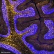 New research finds so called "human accelerated regions" within our genome have played an important role in rewriting the course of human brain development, offering insights into the genetics of human evolution. <a href="/NeuroCellPress/">Neuron</a> spkl.io/601843hPI

@chrisawalsh1@ViolinPlots