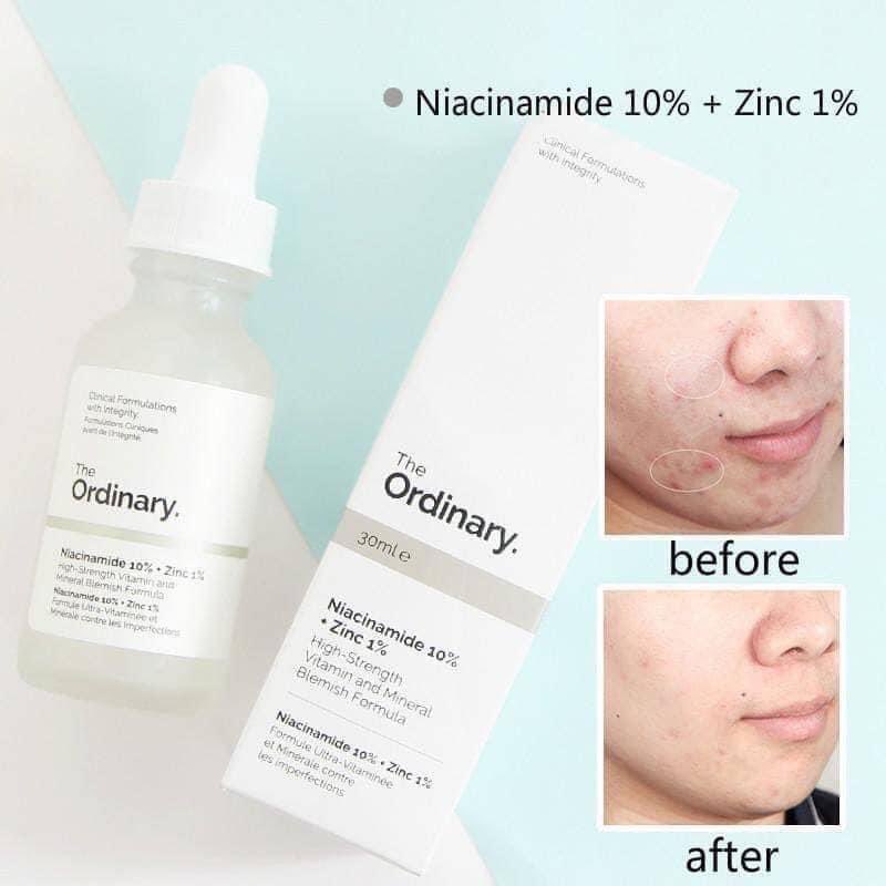 khashopofficial's tweet photo. The Ordinary Niacinamide 10%+Zinc 1%
เซรั่มที่จะช่วยปลอบประโลมผิว ลดสิว ลดรอยดำ/แดงที่เกิดจากสิว ช่วยควบคุมความมันส่วนเกิน ให้ผิวกระชับ และกระจ่างใสขึ้น เนื้อบางเบา ไม่เหนอะหนะ

ราคา 490.-

#ขาช้อปพร้อมส่ง https://t.co/SsaYRBx6ni