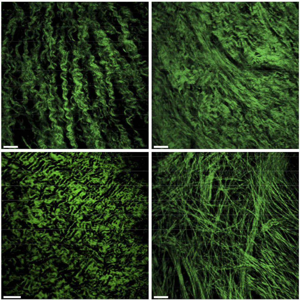 OpticaPubsGroup's tweet image. Via #OSA_BOEx: Machine learning-based rapid diagnosis of human borderline ovarian cancer on second-harmonic generation images ow.ly/gogk50G2edQ #OpticalDiagnostics #ImagingTechniques