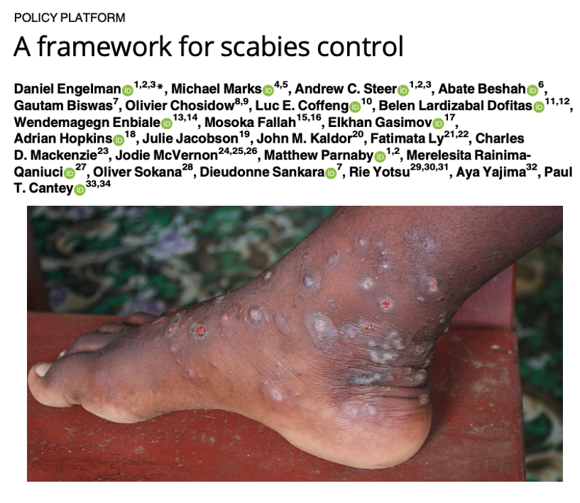 Dan_Engelman's tweet photo. Out today in @PLOSNTDs – our policy paper outlining a Global Framework for #Scabies Control. Drawing on recommendations from @WHO Expert Consultation and #NTDRoadmap.
https://t.co/W1zD2Rl4Bj
#BeatNTDs https://t.co/iDi5zWBj2f