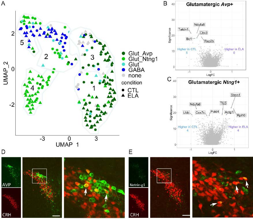 Tallie Z Baram (@z_baram) on Twitter photo Cool <a href="/drbelshort/">Annabel Short</a> & <a href="/calizavi/">Ali Mortazavi</a> single-cell transcriptomics work on #stress-regulating CRH cells in developing hypothalamus. Combined data-and neuroscience-driven clustering identifies novel populations, which are specifically targeted by early-life stress. biorxiv.org/content/10.110… Cool <a href="/drbelshort/">Annabel Short</a> & <a href="/calizavi/">Ali Mortazavi</a> single-cell transcriptomics work on #stress-regulating CRH cells in developing hypothalamus. Combined data-and neuroscience-driven clustering identifies novel populations, which are specifically targeted by early-life stress. biorxiv.org/content/10.110…