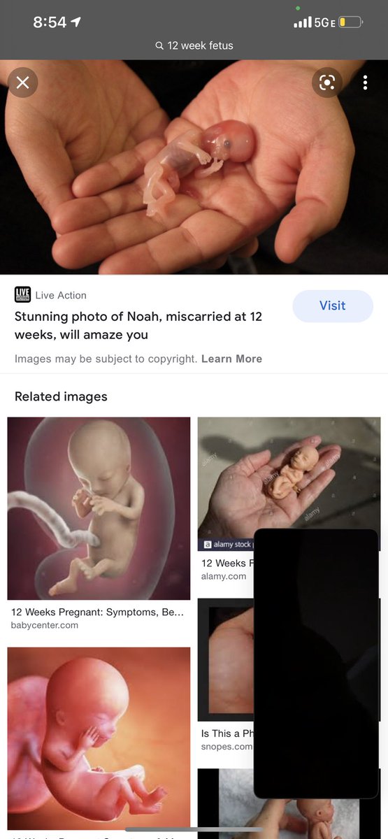 IsabelSpurlin's tweet photo. @stilling_time @AngelaBelcamino @JoeBiden again. this is a 12 week old fetus. can fit in your hand. can’t live on its own. https://t.co/4btrohAAOI