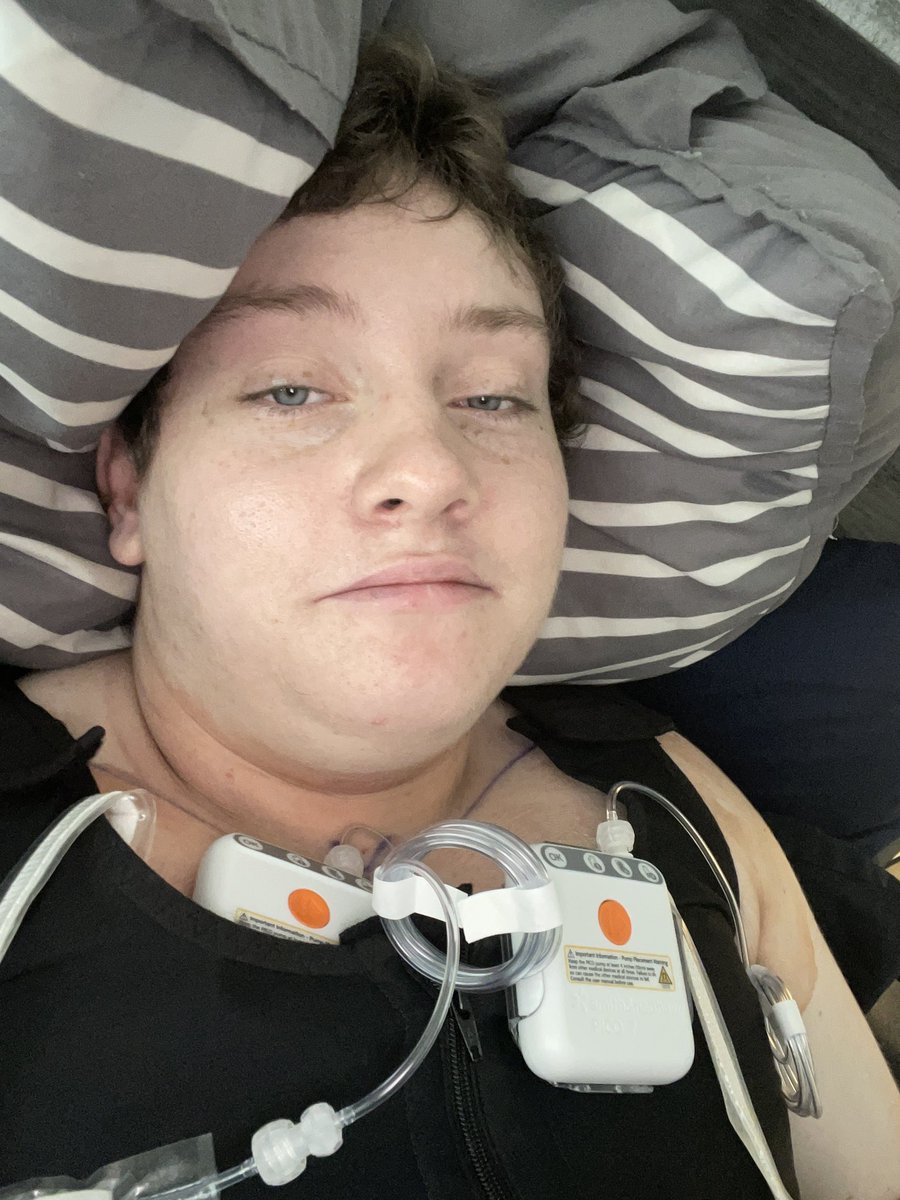 HamOnABicycle's tweet image. TOP SURGERY COMPLETE!!!!