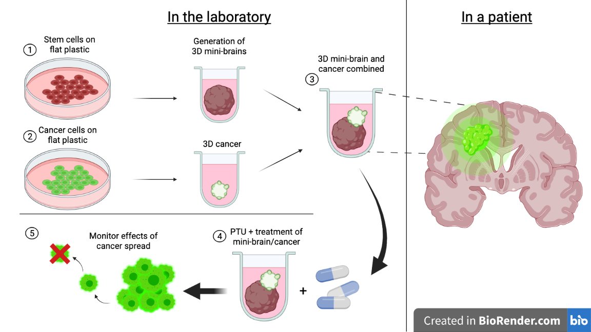 Kids Research (@kids_research) on Twitter photo FAB is one of the groups within the #CCRU, we are working to make kids cancer a disease of the past by giving lab-grown mini-brains mini cancer tumours to test the affect of anti-invasive drugs. <a href="/westmeadkids/">Westmead Kids</a> <a href="/SCHNkids/">Sydney Children's Hospitals Network</a> FAB is one of the groups within the #CCRU, we are working to make kids cancer a disease of the past by giving lab-grown mini-brains mini cancer tumours to test the affect of anti-invasive drugs. <a href="/westmeadkids/">Westmead Kids</a> <a href="/SCHNkids/">Sydney Children's Hospitals Network</a>