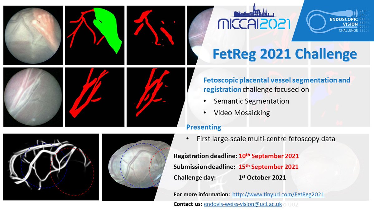 There is still time to participate in #FetReg2021 #EndoVis sub-challenge #MICCAI2021 <a href="/MICCAI_Society/">MICCAI Society</a>

More info: tinyurl.com/FetReg2021

#surgicalAI #fetoscopy #segmentation #video #mosaicking

<a href="/WEISS_UCL/">WEISS</a> <a href="/GIFT_Surg/">GIFT Surg</a> <a href="/DanStoyanov/">Dan Stoyanov</a> <a href="/Alessan55446038/">Alessandro Casella</a> <a href="/saramoccia/">Sara Moccia</a>  <a href="/SpeidelStefanie/">Stefanie Speidel@NCTDresden</a>
