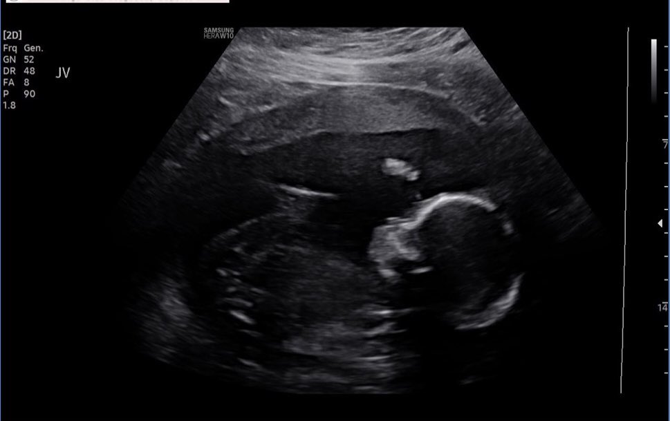 I cannot believe we are in Sept! This is a big year for my hubby and I. Let me recap: we got a puppy (Canelo) in Feb., received keys for our new home in April, baptized our nephew in May, and we're ending the year with the arrival of our babygirl due in Nov! Feeling so #Blessed