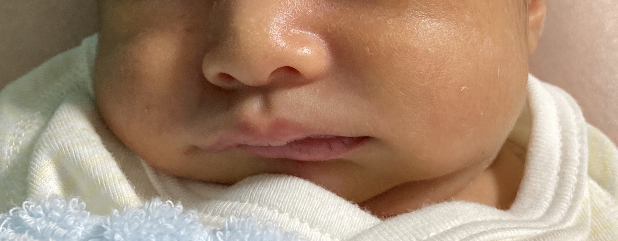 さくらもと かおる おっ子ギャン泣き中のギャン泣きすると顔真っ赤っかにして顔くしゃくしゃになるから梅干くんと呼んでいる 立派なオナラした時はぷっぷくん 機嫌いい時は もちもちくん あだ名たくさんある我が子 ほっぺ食べたい なんで赤ちゃんの二
