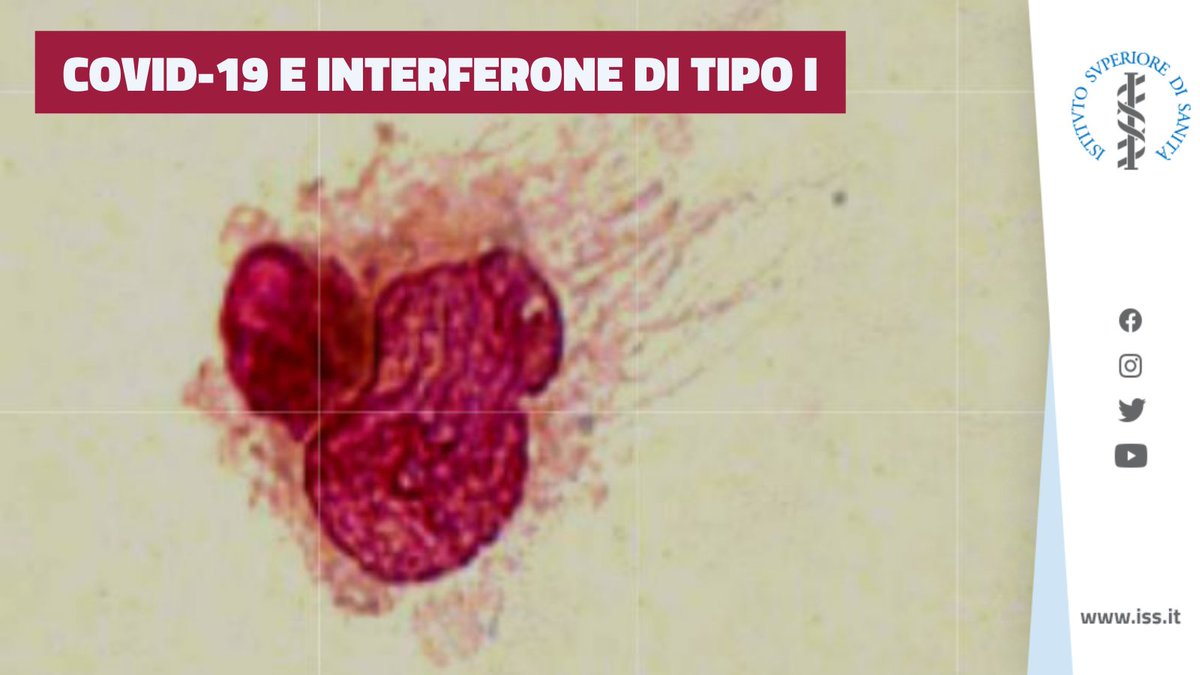 istsupsan's tweet photo. 🔬#COVID19 STUDIO ISS SU RUOLO PROTETTIVO CELLULE DENDRITICHE PLASMACITOIDI (pDC)
🦠virus stimola rilascio #Interferone (IFN) di tipo I (potente antivirale) dalle pDC
⚖️frequenza pDC e livelli sierici IFN differenti in infezione grave⬇ o asintomatica⬆
👇
https://t.co/Iz4U5IWywC https://t.co/JKmt8hpoIw