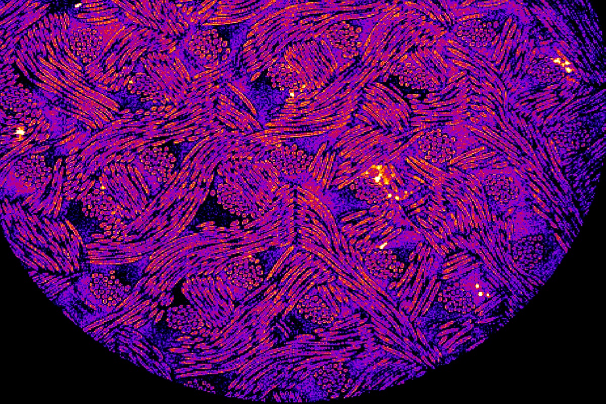 Press release on our new study, showing we can treat RA in mice using genome-engineered cells that release biologic drugs when they sense inflammation. Great work by Yun-Rak Choi, Kelsey Collins &amp; many other members of @guilak_lab! medicine.wustl.edu/news/rheumatoi… 
science.org/doi/10.1126/sc…