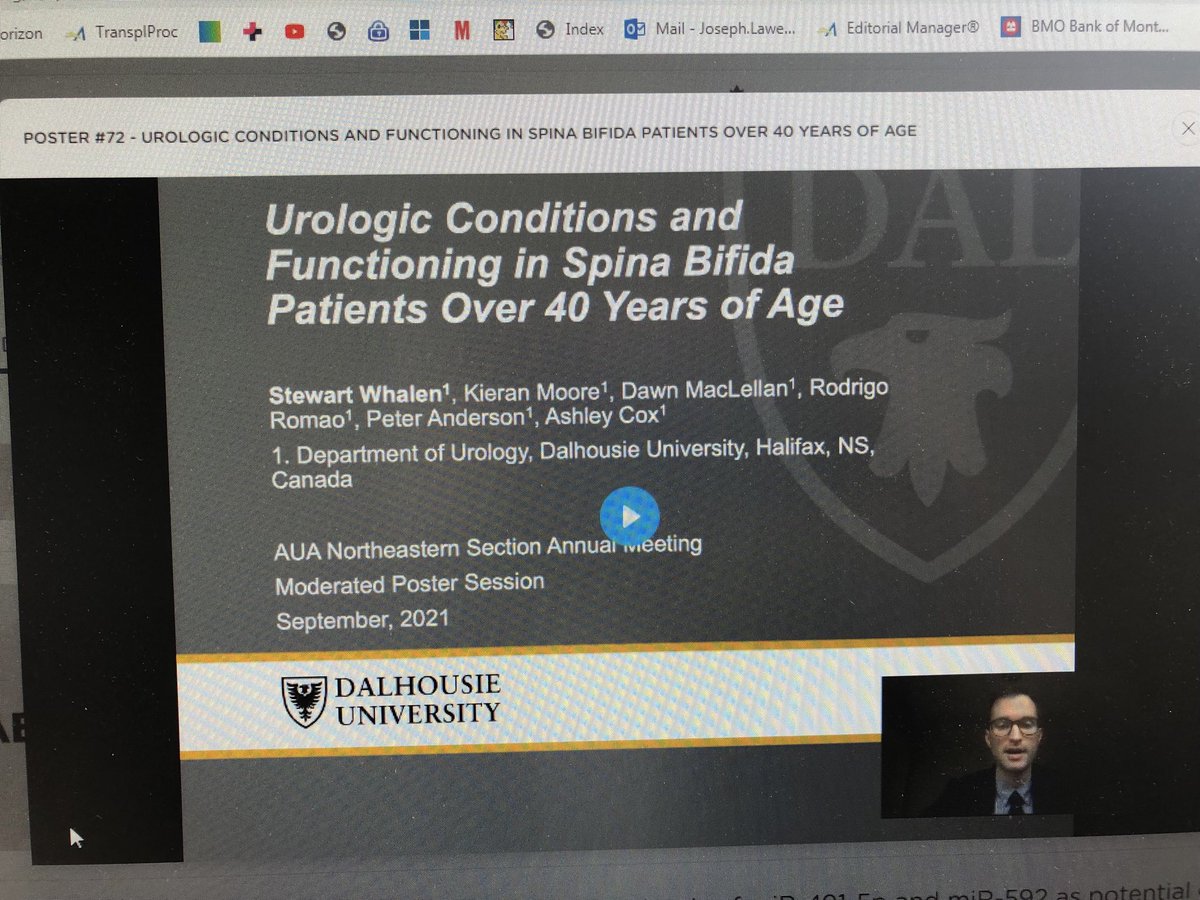 ashley cox (@ashleycox1000) on Twitter photo Great presentation by Dr. Stew Whalen highlighting challenges caring for adults with #SpinaBifida #nsaua <a href="/DalUrology/">DalUrology</a> <a href="/rod_romao/">Rodrigo Romao</a> Great presentation by Dr. Stew Whalen highlighting challenges caring for adults with #SpinaBifida #nsaua <a href="/DalUrology/">DalUrology</a> <a href="/rod_romao/">Rodrigo Romao</a>