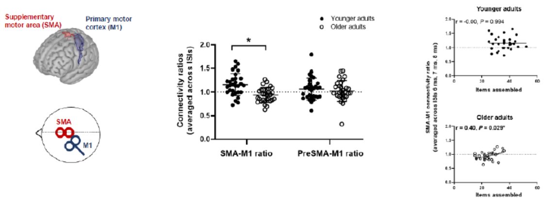 JohnnyFoxe's tweet photo. JUST RELEASED in @EJNeuroscience 
Reduced SMA‐M1 connectivity in older than younger adults measured using dual‐site TMS 
@BKRurak of Murdoch University Research
@MUniResearch
https://t.co/XhAE9l69P7 https://t.co/3Q6qMle8A3