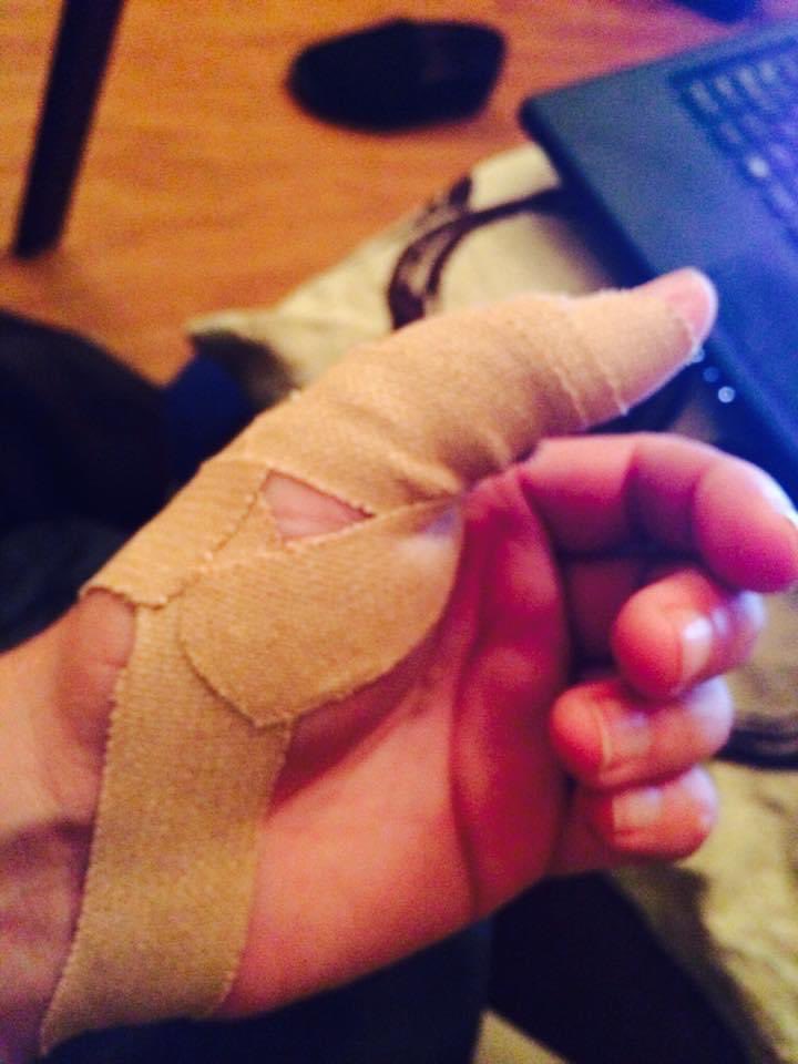 forthelostsoul's tweet photo. 8 years ago today I made a fantastic double save in training (as manager) it was an #ouchie moment! #football #dislocatedthumb https://t.co/VyU0dIBPzr