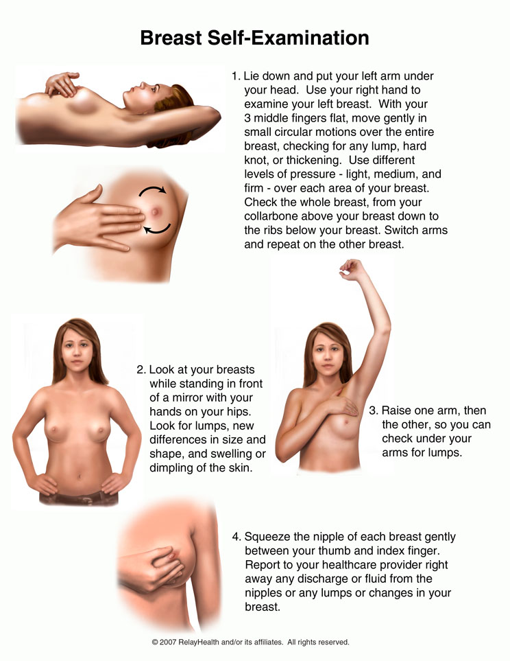 xsurgeon (@xsurgeon3) on Twitter photo #generalsurgery breast cancer is a common cause of admission in our department <a href="/efsthsurgery/">EFSTH Surgery</a>, we have to educate our patient about to detect any abnormal findings and get appointments with Drs ASAP. ๐๐ฝ #generalsurgery breast cancer is a common cause of admission in our department <a href="/efsthsurgery/">EFSTH Surgery</a>, we have to educate our patient about to detect any abnormal findings and get appointments with Drs ASAP. ๐๐ฝ