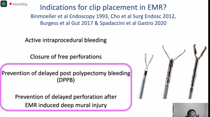 drmanmeetm's tweet photo. Judicious and considered use of clip placement with data presented by @DrMattChoy @UniMelb 
Important considerations for #patientsafety and #greenendoscopy
#ENDOcation https://t.co/wUkL8JcfSv