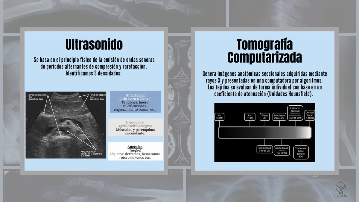 CICoMedicine's tweet photo. Te invitamos a conocer las generalidades detrás de las 4 herramientas de imagen más utilizadas en la práctica médica.

#CICOM #medicina #medicine #medicalstudent #science #radiology #imagenologia https://t.co/3VxeLCyLtY