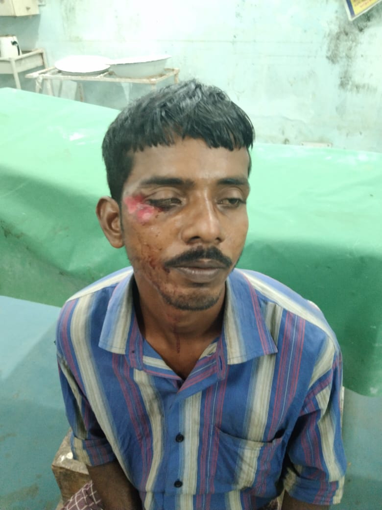 vaskarsarkar11's tweet photo. The forest kingdom is going on in Tripura under the leadership of Bilpab kr Deb.Left Farmer leader(#cpim) Gautam Ghosh is being treated at a hospital in East Palatana after being attacked by BJP miscreants and byke goons 
@Bjp_Liton @BJP4Bengal @BJP4India @BJPTripura https://t.co/WMefmzA297