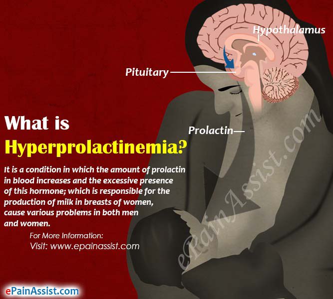 Повышенный пролактин гипофиз. Гиперпролактинемия форум. Hyperprolactinemia causes Symptoms. How to diagnose Hyperprolactinemia. Prolactin and seizure activity.