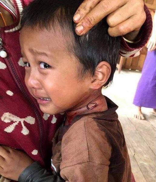 BurmaSpring2021's tweet photo. Myanmar children,under siege as Junta &amp; accomplices have killed 75 children including under-ages &amp; arbitrarily detained more than hundreds,trivializing ASEAN's effort,int'l sanctions &amp; statements. #TakeAction_NoMoreWords  #WhatsHappeningInMyanmar #Sep4Coup https://t.co/ekOPELMcVd