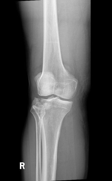 Krishna Murprayana tweet media