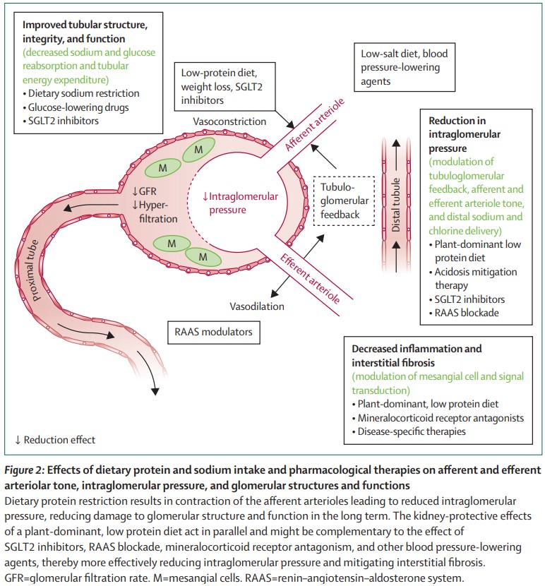 The Lancet (@thelancet) on Twitter photo By 2040, chronic kidney disease is estimated to become the 5th leading cause of death globally.
<a href="/kamkalantar/">Kam Kalantar-Zadeh, MD, MPH, PhD</a> and colleagues provide a Seminar on the disease and discuss kidney function-preserving lifestyle, dietary, and pharmacological strategies. hubs.li/H0WthV_0 By 2040, chronic kidney disease is estimated to become the 5th leading cause of death globally.
<a href="/kamkalantar/">Kam Kalantar-Zadeh, MD, MPH, PhD</a> and colleagues provide a Seminar on the disease and discuss kidney function-preserving lifestyle, dietary, and pharmacological strategies. hubs.li/H0WthV_0