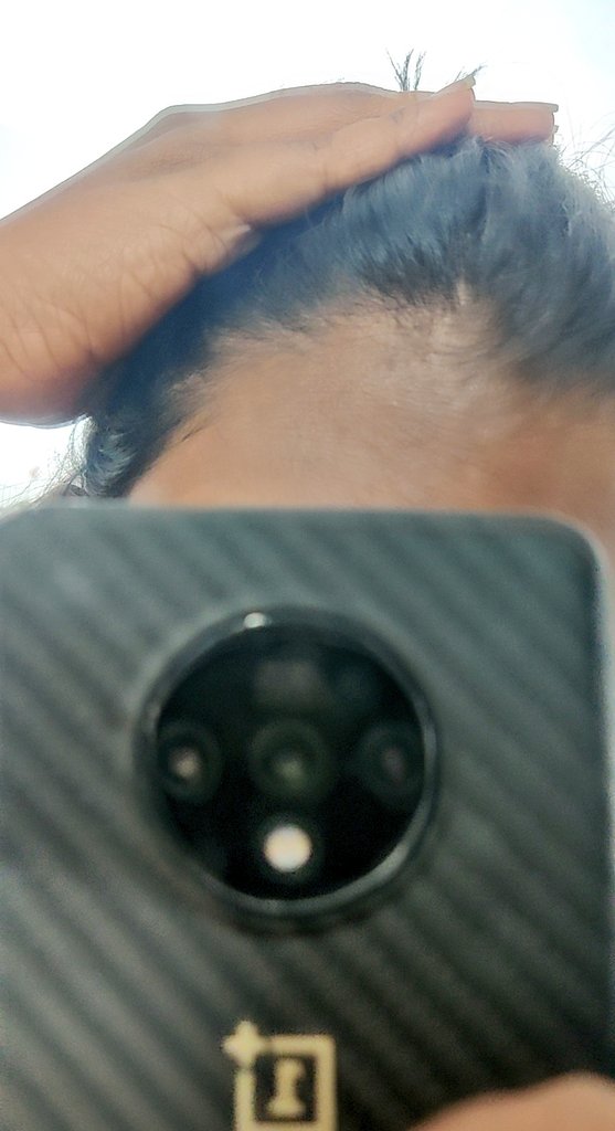 epudiii_thaano's tweet photo. Ippove 2 inch ku mandaila gap 🥲 innum evlo naal pa mothama poga potho..! Vayasaagiruchu Kumaaru 🤧
#baldtwitter https://t.co/FoS6JfZmVo
