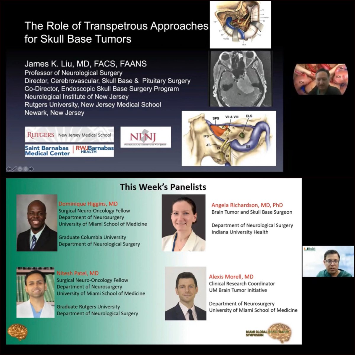 Outstanding talk this past week by <a href="/SkullBaseMD/">James K. Liu, MD</a> on The Role of Transpetrous Approaches for #SkullBase Tumors.  If you missed it, check it out on YouTube here: youtu.be/hJuXGa8JQaU Also great to hear from <a href="/AngelaMRichard1/">Angela M Richardson, MD, PhD</a> <a href="/patelnv/">Nitesh V Patel, MD</a> <a href="/dmohiggins/">Dominique Higgins</a> Next symposium is 10/6
⁣⁣
