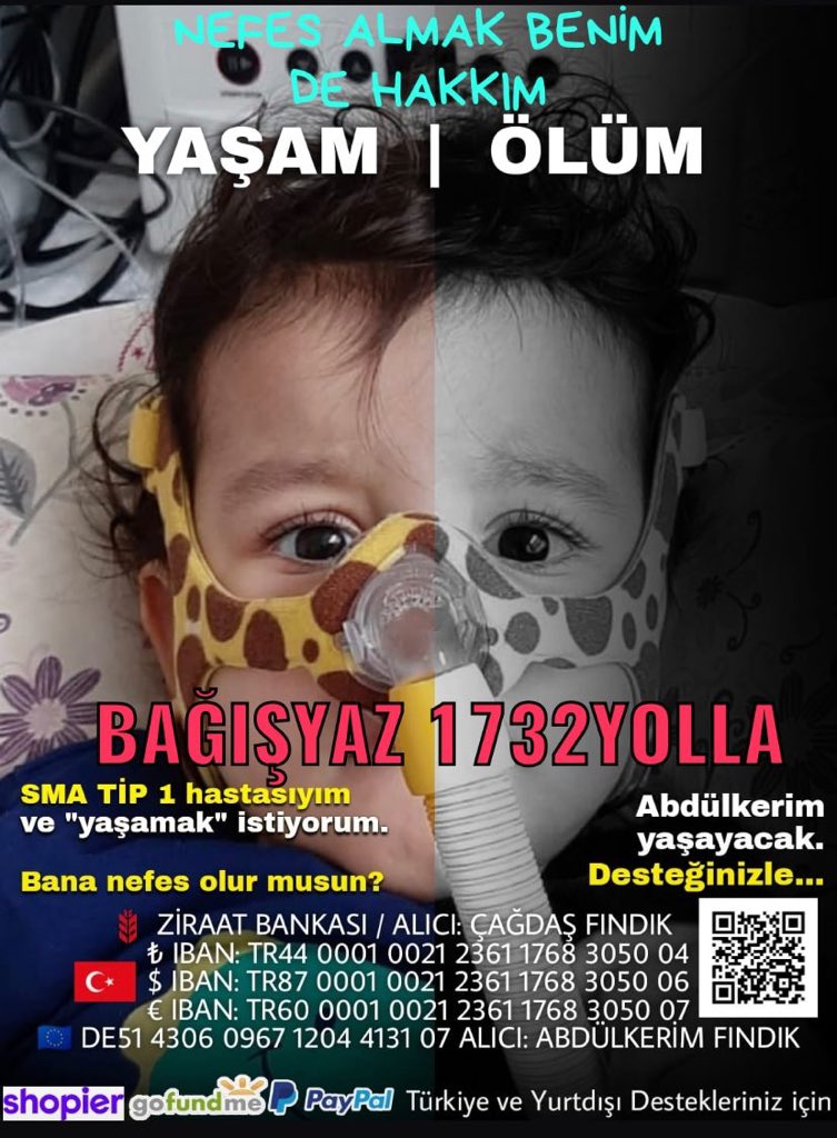 Abdulkerim bizlerden destek bekliyor #AbdulkerimMesutOlsun