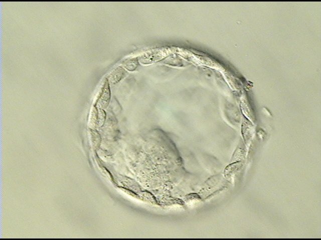 wellofintention's tweet photo. About 2 weeks longer than this gestation I was 6 weeks pregnant. This is not a baby. This is a lump of cells. My body and my life means more than the contents of this picture. #mybodymychoice https://t.co/Wp7p7vlfyH