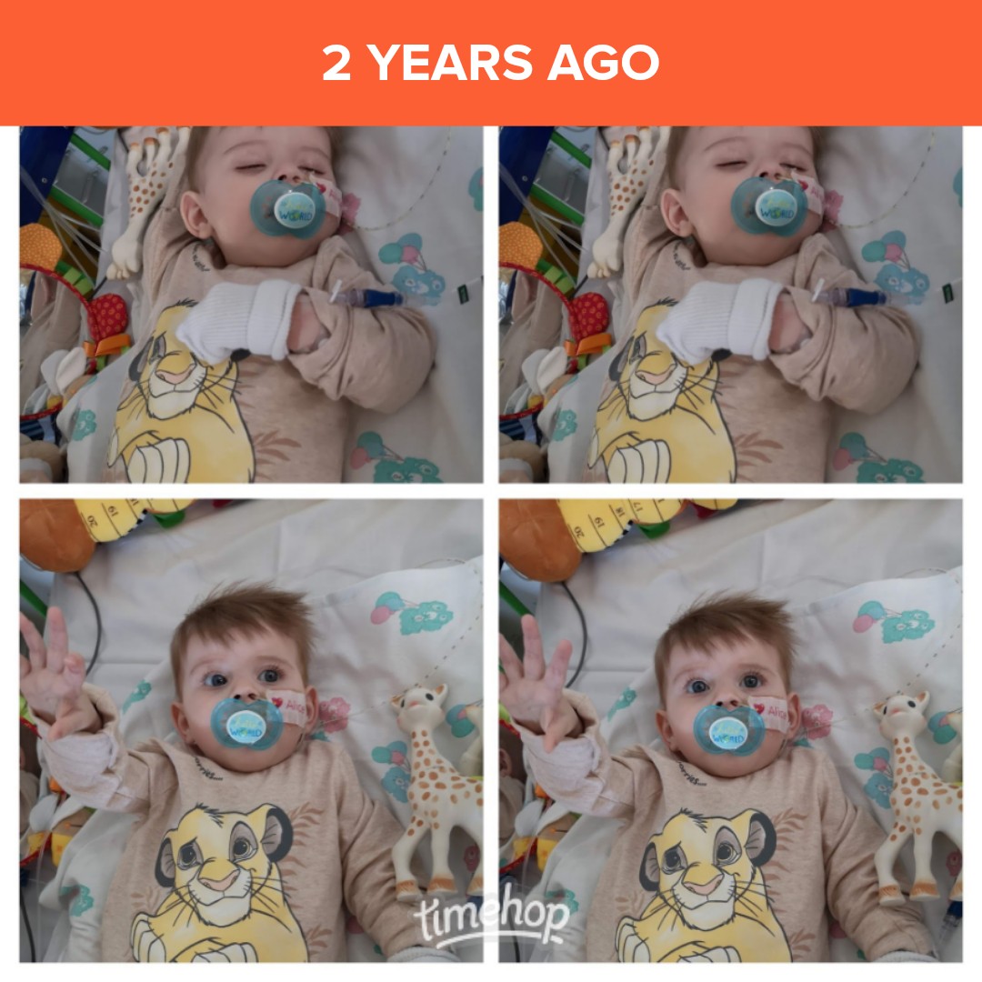 Majella_Spang's tweet photo. Sweet beautiful Alice in ICU before her stoma surgery @janbartspang #dilatedcardiomyopathy #gonetoosoon #heartbaby #heartbroken #amazingalice #restrictivecardiomyopathy #grief https://t.co/X2VEl7qoYJ