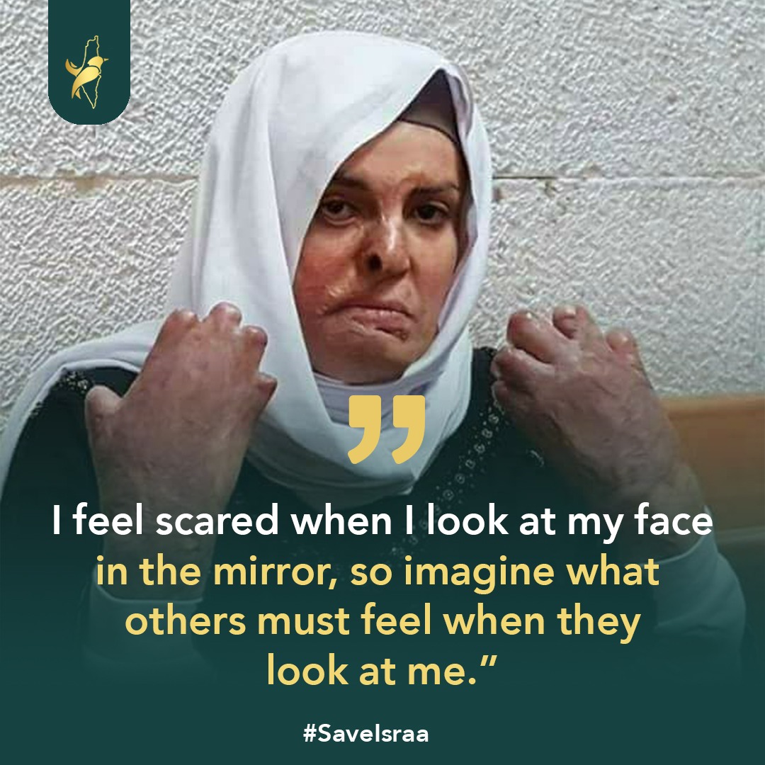 TranslateForPa2's tweet photo. #SaveIsraa 
#انقذوا_اسراء_جعابيص https://t.co/2Pj5gUbOVh