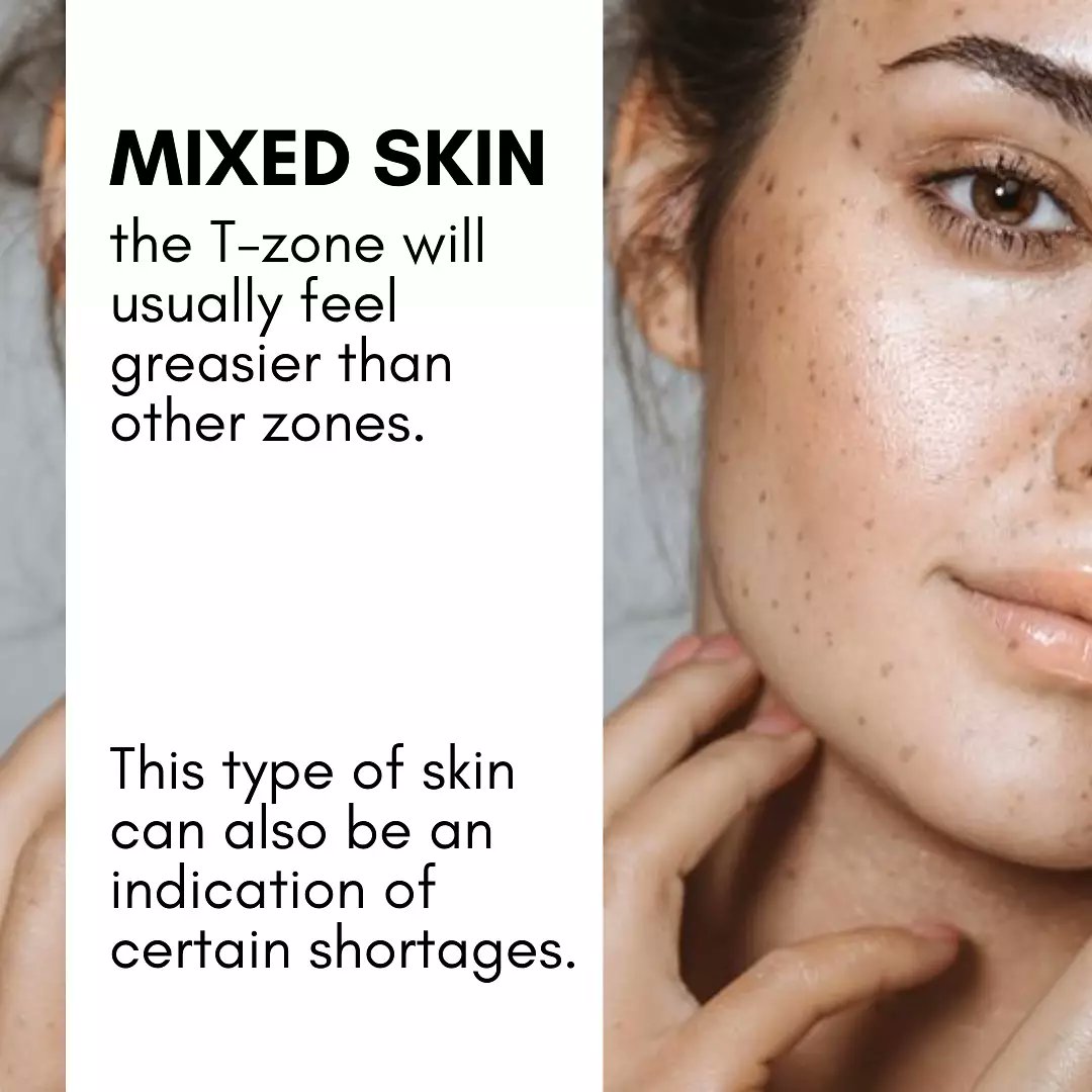 Generally skin types can be sorted in the following categories. #skincare #Skin #beauty #BeautyCare