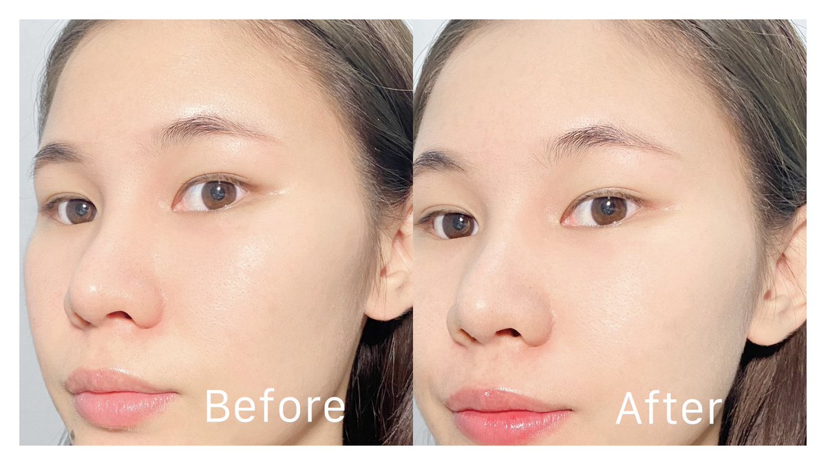 nnannie_e's tweet image. ใช้มาขวดที่ 2 แล้ว แป้งฝุ่น Sasi acne sol 💚ตัวนี้ เนื้อเค้าเนียนละเอียด แล้วช่วยควบคุมความมัน + ลดการเกิดสิว เหมาะมากใช้วันแต่งหน้าเบาๆแบบบางแป้งบางๆอยู่บ้าน น้องขวดปุ้กปิ๊กจะพกพาก็ได้นะ หาซื้อง่ายมั๊ก 7-11 ก็มีเเล้วว #ไว้รีวิวห้ามขายของโว้ย