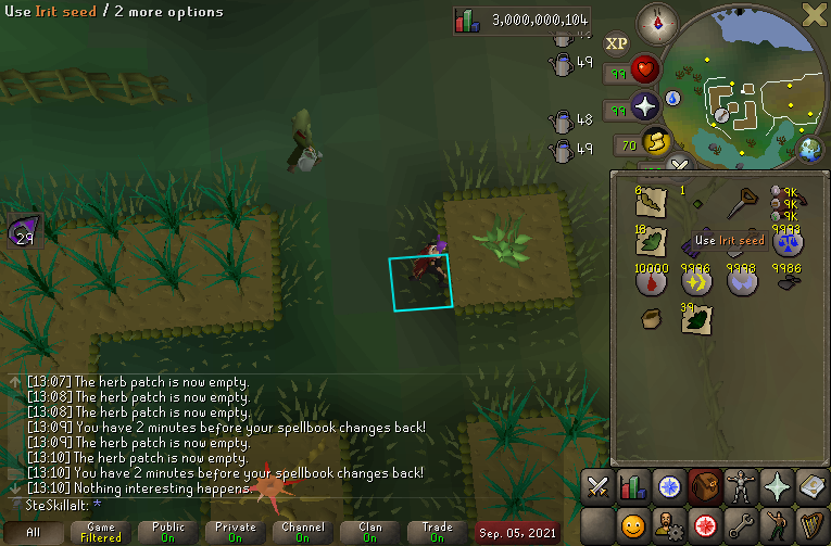 3b xp