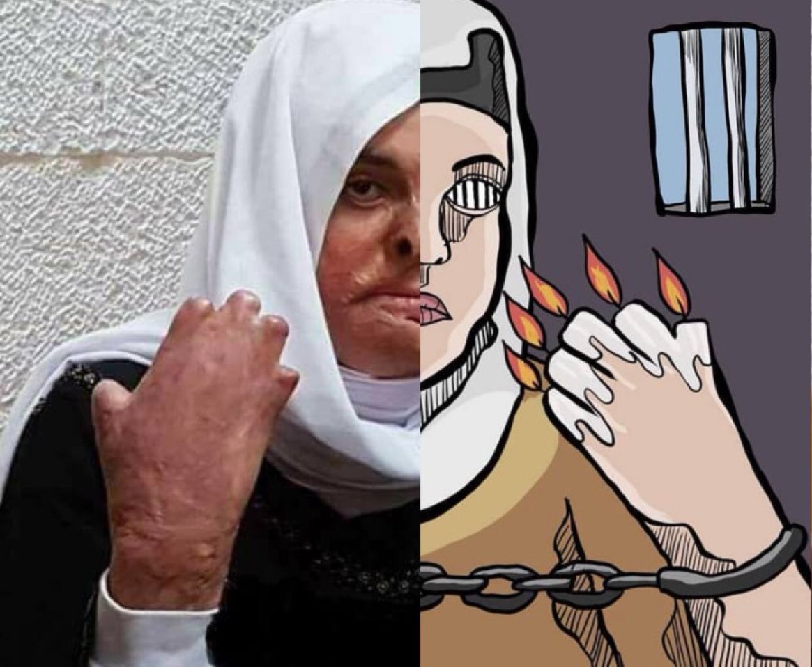 SamarDJarrah's tweet photo. ياترى هل ممكن لمشهور او مشهورة، أمير او أميرة، شيخ او شيخة، ملك او ملكة، مطرب او مطربة التوسط لاطلاق سراح الاسيرة إسراء لتلقي العلاج المناسب لحروقها؟ #انقذوا_اسراء_جعابيص https://t.co/5uyUMZLAYN
