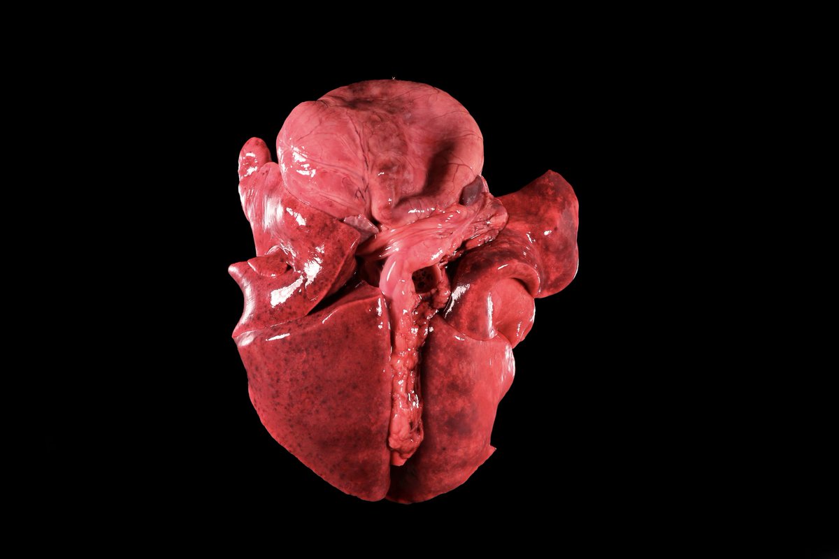 APowersPatho's tweet image. Day 4 of #grosspathology for the perusal of #TwitterPathology. In addition to the hemorrhage here, this patient had lost 30% of its estimated blood volume into the abdomen, thorax and pericardium. There was also mediastinal hemorrhage. #vetpathology #rodenticidetoxicity