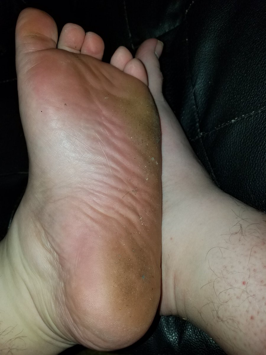 mistertoejam's tweet photo. They are a tad bit dirty.....I need some volunteers to clean them!!!! #footfetish #feetfetish #malefeet #guyfeet #dirtyfeet #stinkyfeet #sexyfeet #stinkyfeet #smellyfeet #sweatyfeet https://t.co/TXHth6TcQX